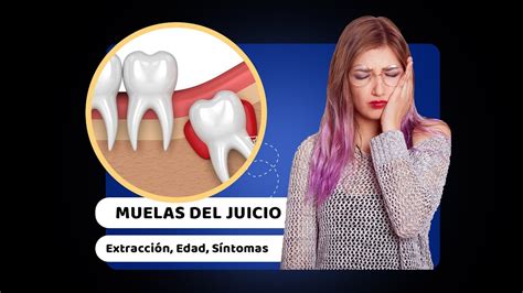 Muelas Del Juicio Quito Extracci N Edad S Ntomas Precio