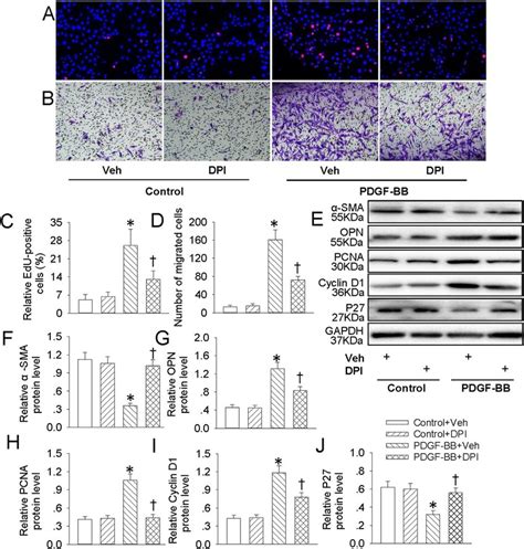 Dpi Retarded Pdgf Bb Induced Vsmc Dedifferentiation Proliferation And