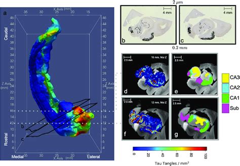 Distributions Of Neurofibrillary Tau Tangle Nft Density Reconstructed