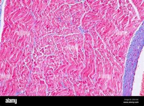 Micrografia Del Muscolo Cardiaco Fotografías E Imágenes De Alta