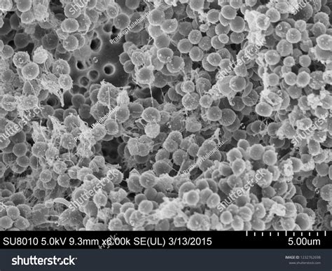 Staphylococcus Aureus Scanning Electron Microscopy Foto Stok 1232762698