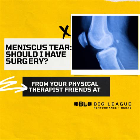 Meniscus Tear: Should I Have Surgery? - Washington DC Physical Therapy ...