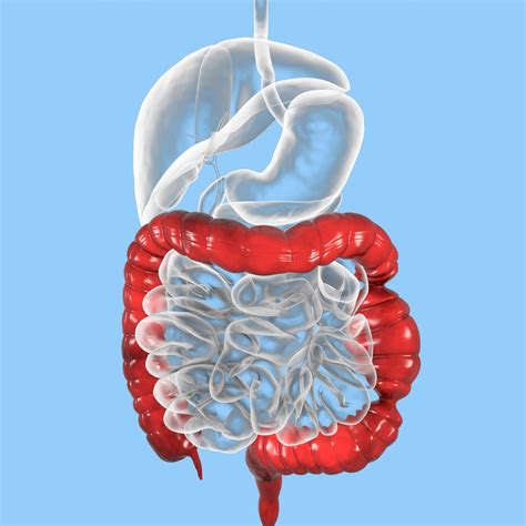 Síndrome do intestino irritável o que é causas sintomas e tratamento