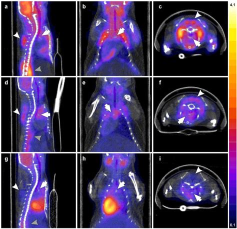 PET CT Imaging Fusion PET CT Images Acquired 2 5 To 3 H After The