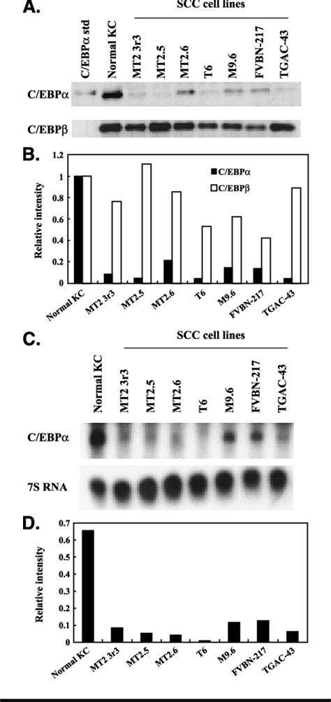 Figure 1 from Diminished Expression of C EBPα in Skin Carcinomas Is