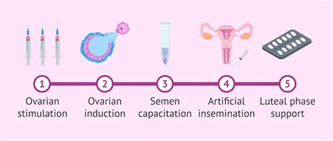 Steps In Artificial Insemination Ai Treatment