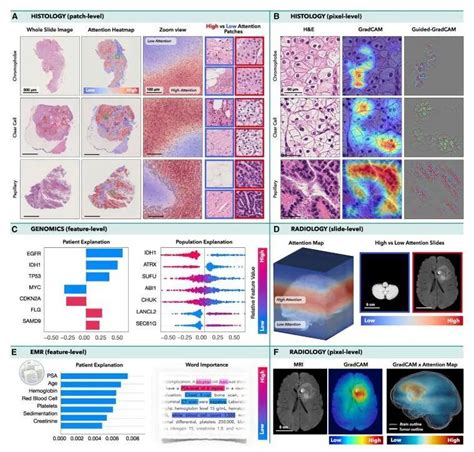 Cancer Cell Ai集成肿瘤多模态数据：数据融合和关联发现 知乎