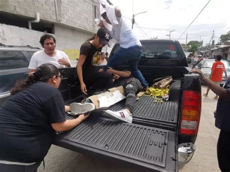 Con fractura expuesta terminó un motociclista tras derrapar en ciudad