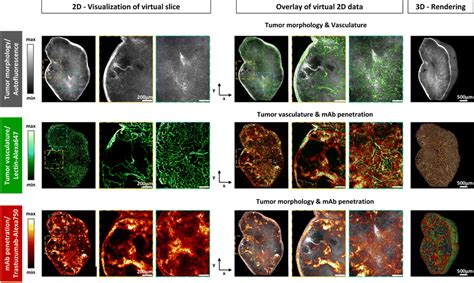 Multispectral 3d Lsfm Imaging Of Tumor Biology And Drug Penetration In