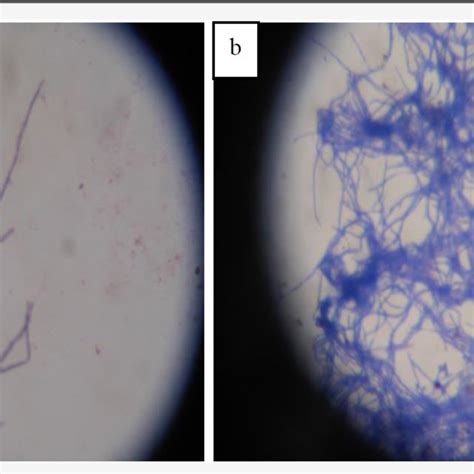 Pigments Produced By Streptomyces Isolates In Starch Casein Agar After