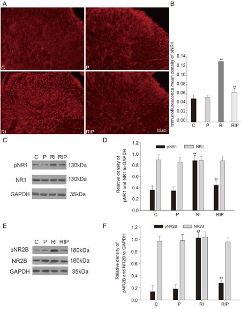 Figure 5 From Intraoperative Infusion Of Remifentanil Induces