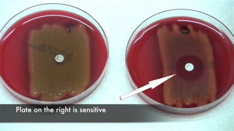 Bacitracin Test For Streptococcus Pyogenes Youtube