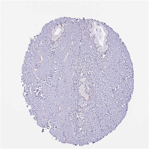 Tissue Expression Of Pabir1 Staining In Cervix The Human Protein Atlas