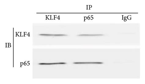 Klf4 And Nf κ B P65 Cooperatively Induce The Il 6 Promoter Klf4 And