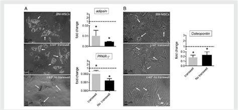 Adipogenic And Osteogenic Differentiation Of Bm Derived Mscs Transwell