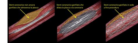 Malva Supermercato Ascesa Malattia Dei Tre Vasi Definizione Istituzione