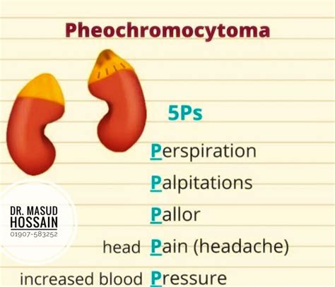 ফিওক্রোমোসাইটোমা- Pheochromocytoma Treatment | Homeo Treatment