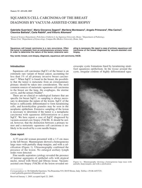 Pdf Squamous Cell Carcinoma Of The Breast Diagnosis By Vacuum