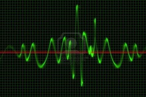 Oscilloscope Wave Sound Pattern | Wave pattern, Sound waves, Waves