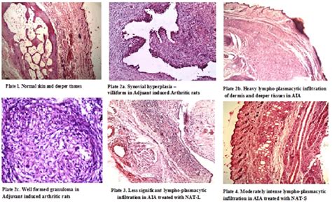 Histopathological Examination Of Normal Arthritis Induced And