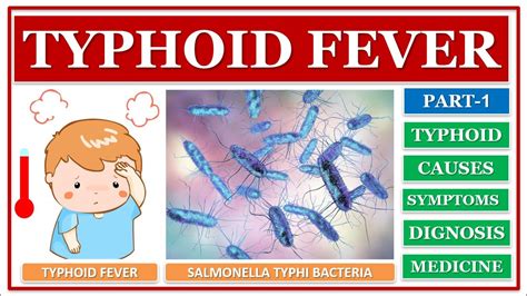 Typhoid Fever Symptoms And Causes