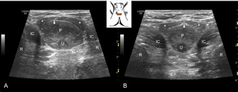 Musculoskeletal Sonography And Occupational Performance Laboratory Msop