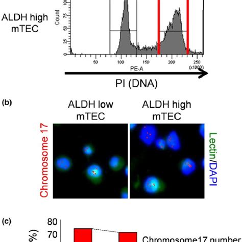 High Aldehyde Dehydrogenase Activity Tumor Endothelial Cells ALDH High