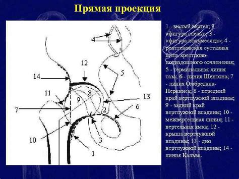 Повреждения проксимального отдела бедра Рентгеноанатомия тазобедренного ...