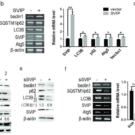 Autophagy Western Blot Sexiz Pix