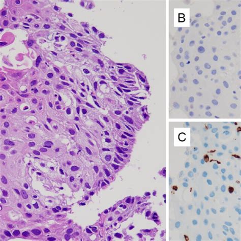 Figure3 Histopathology Of The Lung Tumor Hematoxylin And Eosin Download Scientific Diagram