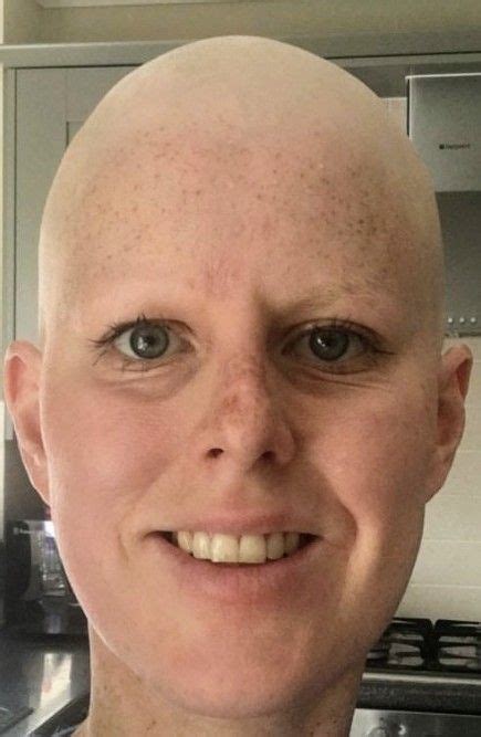 Pin By Andrea Slim On Hair Short Shorter Shaved Bald Head