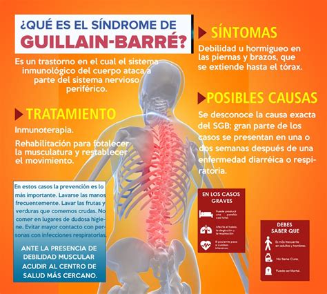 El Síndrome De Guillain Barré Noticias Unica Free Download Nude