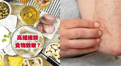 濕疹、皮膚痕癢要戒口組織胺誘發哪些屬高組織胺食物 冷敷5分鐘可止痕 明報健康網