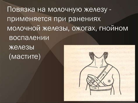 Повязки, накладываемые на грудную клетку - презентация онлайн