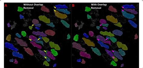 Effect Of Overlapping Instance Removal On Segmentation Predictions Raw