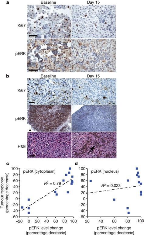 Semi Quantitative Immunohistochemistry Ihc In Paired Tumour