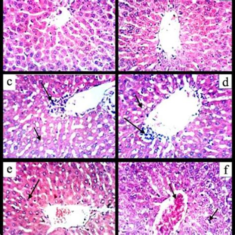 A Photomicrograph Of The Liver Of Control Rats Ab Showing Normal Download Scientific Diagram