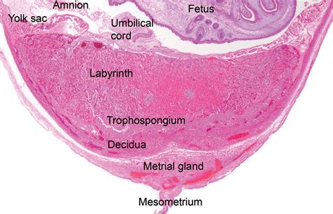 The Placenta In Toxicology Part III Pathologic Assessment Of The