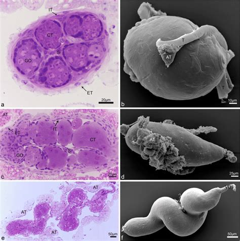 Overview Of The Testes Of Larvae Pupae And Adults By Light Microscopy