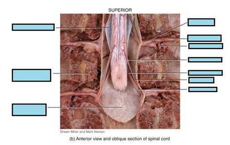 Branches Of A Typical Spinal Nerve Cadaver Diagram Quizlet