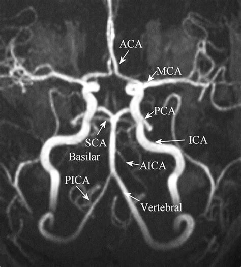 Neck Angio Mri Images - mapasgmaes