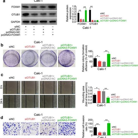 Knockdown Of OTUB1 Suppressed Cell Proliferation Migration And