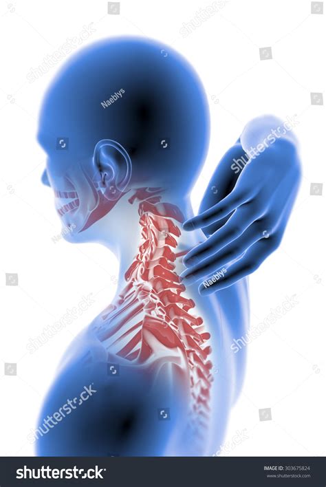 Man Anatomy Neck Pain Muscle Head Stock Illustration 303675824