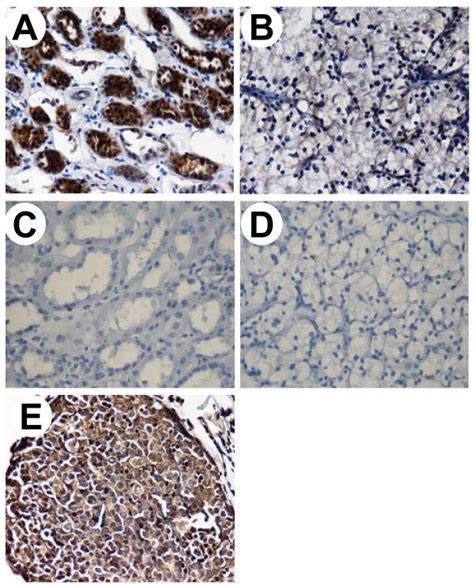 Immunohistochemical Staining Of Cytoplastic Egfr In Normal Parenchymal