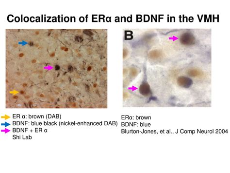 Ppt Sex Differences In Central Expression And Effects Of Brain