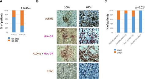 Comparison Of Aldh1 Cd68 And Hla Dr Expression In Stromal Cells A