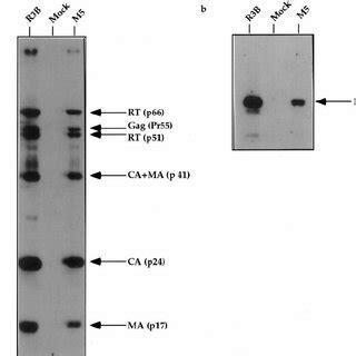 Western analysis of viral proteins in the wild-type and mutant virion ... 