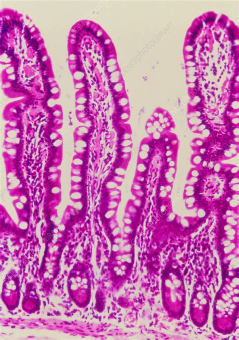 LM Of A Section Through Intestinal Villi Crypts Stock Image P520