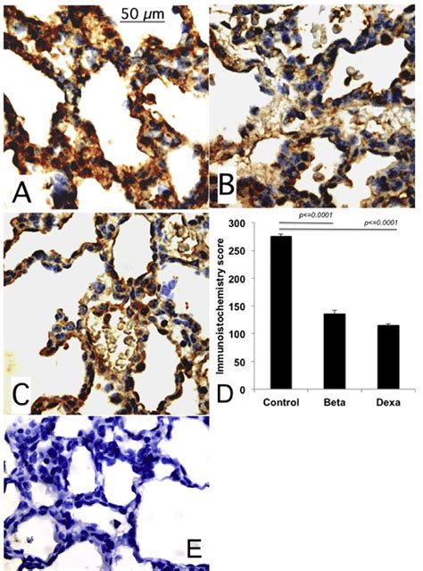 SPLA2 IIA Immunohistochemistry Panel A B And C Show Immunostained