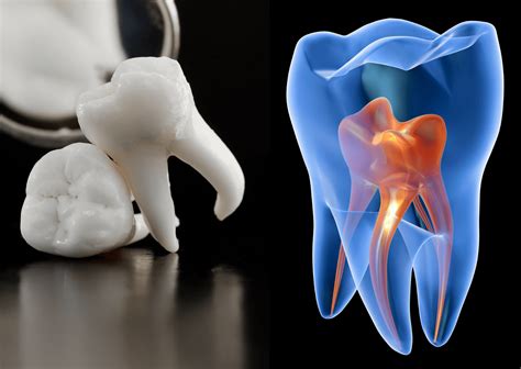 Dental Pulp A Friendly And Fascinating Guide